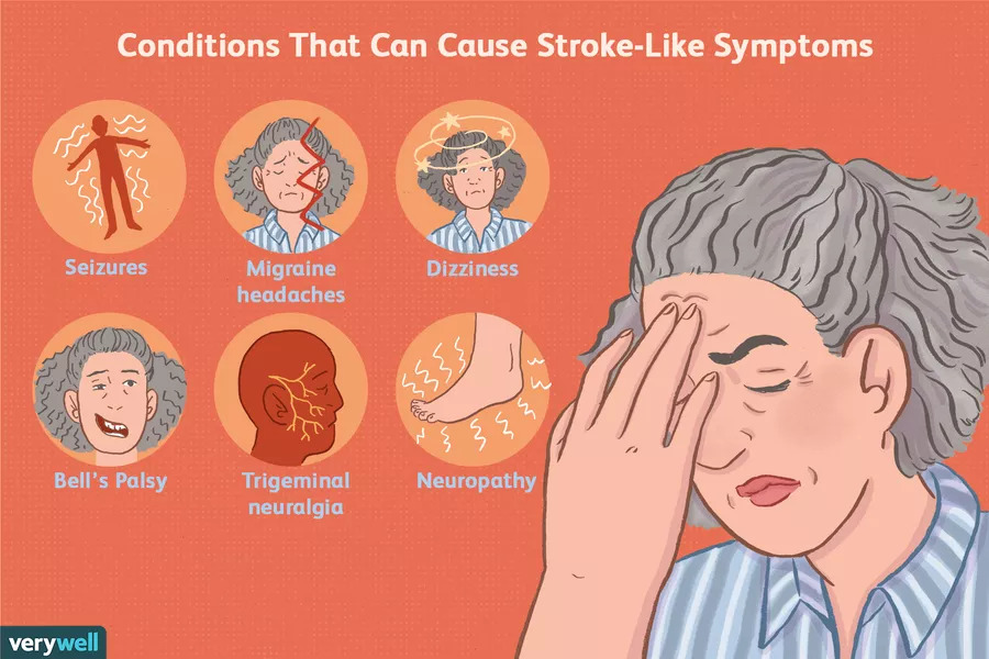 apa-itu-cerebrovascular-penyakit-cerebrovascular-part-1-yayu-nidaul-f